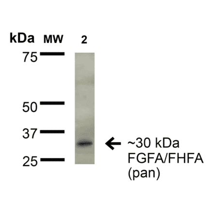 Western Blot - Anti-FGF13 Antibody [S235-22] (A304756) - Antibodies.com