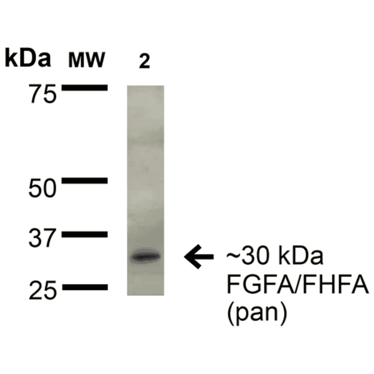 Western Blot - Anti-FGF13 Antibody [S235-22] (A304756) - Antibodies.com