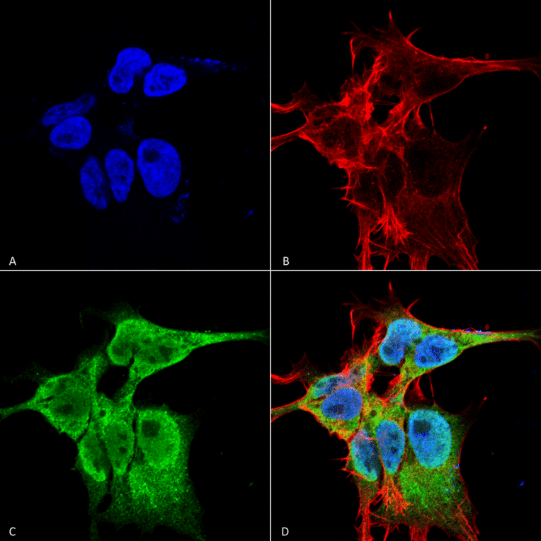 Immunocytochemistry/Immunofluorescence - Anti-FGF13 Antibody [S235-22] (A304756) - Antibodies.com