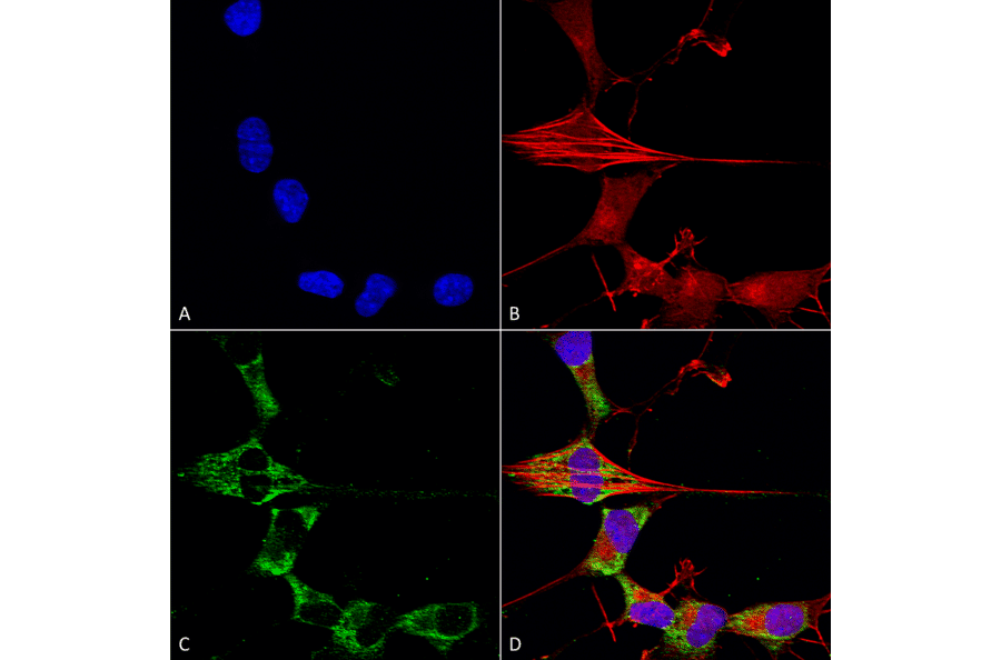 Immunocytochemistry/Immunofluorescence - Anti-FGF13 Antibody [S235-22] (A304756) - Antibodies.com