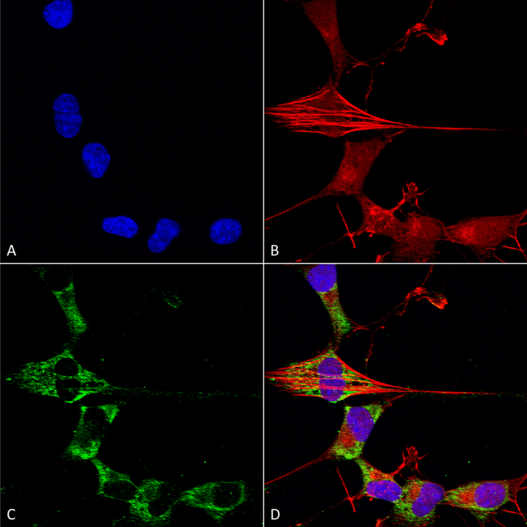 Immunocytochemistry/Immunofluorescence - Anti-FGF13 Antibody [S235-22] (A304756) - Antibodies.com