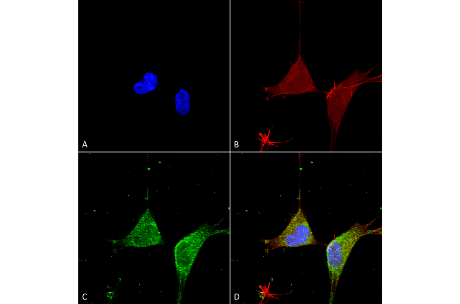 Immunocytochemistry/Immunofluorescence - Anti-GABA A Receptor alpha 5 / GABRA5 Antibody [S415-24] (A304757) - Antibodies.com