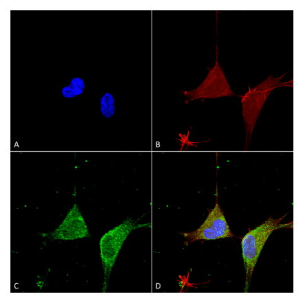 Immunocytochemistry/Immunofluorescence - Anti-GABA A Receptor alpha 5 / GABRA5 Antibody [S415-24] (A304757) - Antibodies.com