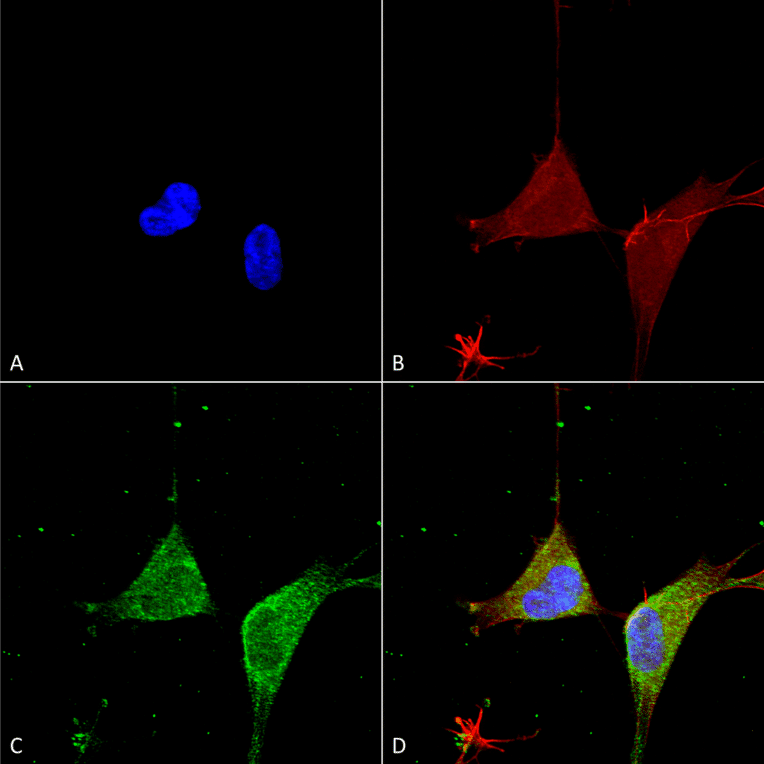 Immunocytochemistry/Immunofluorescence - Anti-GABA A Receptor alpha 5 / GABRA5 Antibody [S415-24] (A304757) - Antibodies.com