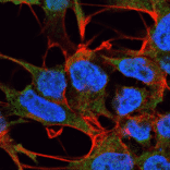 Immunocytochemistry/Immunofluorescence - Anti-GABA A Receptor alpha 5 / GABRA5 Antibody [S415-24] (A304757) - Antibodies.com