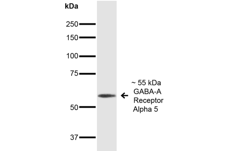 Western Blot - Anti-GABA A Receptor alpha 5 / GABRA5 Antibody [S415-24] (A304757) - Antibodies.com