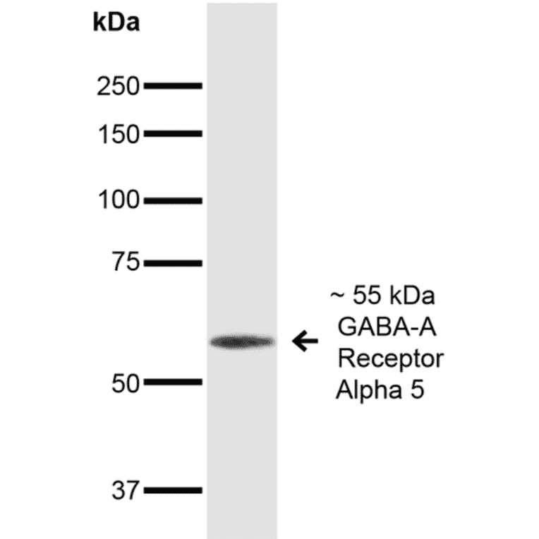 Western Blot - Anti-GABA A Receptor alpha 5 / GABRA5 Antibody [S415-24] (A304757) - Antibodies.com