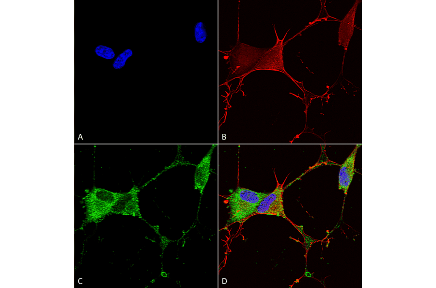 Immunocytochemistry/Immunofluorescence - Anti-GABA B Receptor 2 / GABBR2 Antibody [S81-2] (A304758) - Antibodies.com