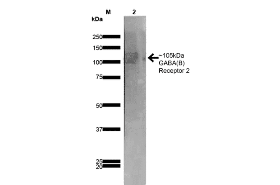 Western Blot - Anti-GABA B Receptor 2 / GABBR2 Antibody [S81-2] (A304758) - Antibodies.com