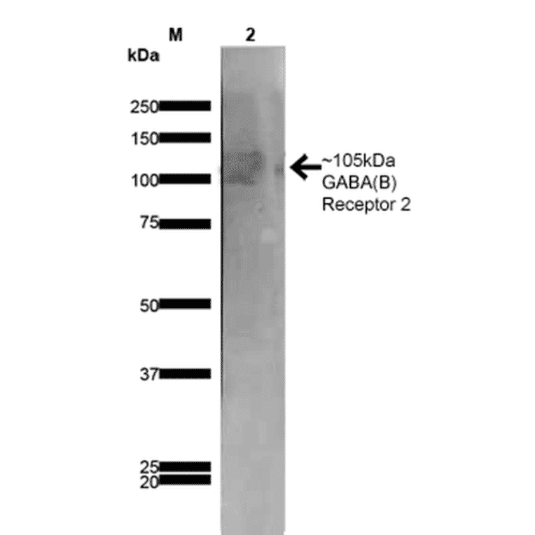 Western Blot - Anti-GABA B Receptor 2 / GABBR2 Antibody [S81-2] (A304758) - Antibodies.com