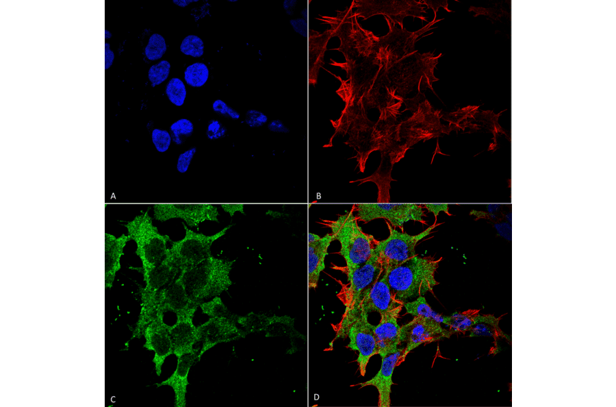 Immunocytochemistry/Immunofluorescence - Anti-GABA B Receptor 2 / GABBR2 Antibody [S81-2] (A304758) - Antibodies.com