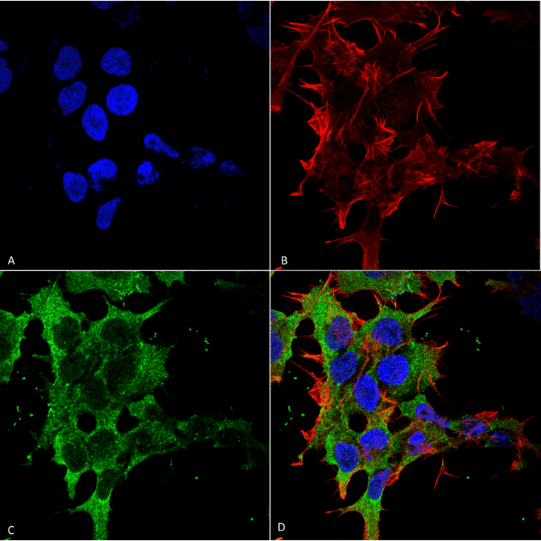 Immunocytochemistry/Immunofluorescence - Anti-GABA B Receptor 2 / GABBR2 Antibody [S81-2] (A304758) - Antibodies.com