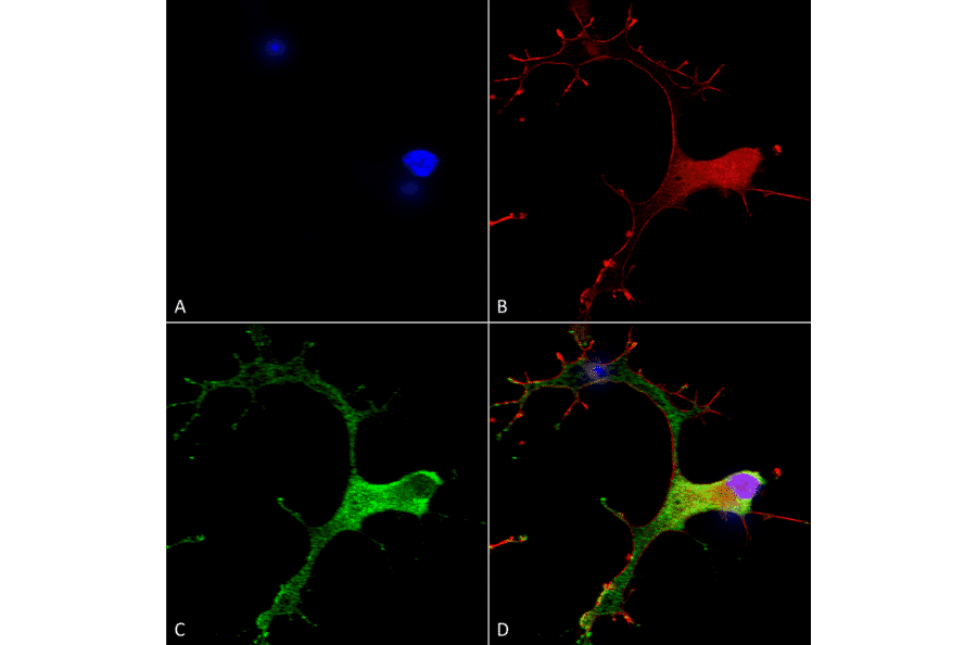 Immunocytochemistry/Immunofluorescence - Anti-GABA B Receptor 1 Antibody [S93A-49] (A304759) - Antibodies.com