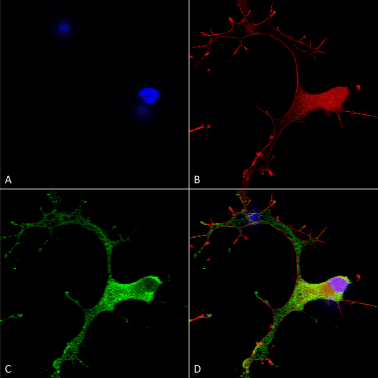 Immunocytochemistry/Immunofluorescence - Anti-GABA B Receptor 1 Antibody [S93A-49] (A304759) - Antibodies.com