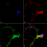 Immunocytochemistry/Immunofluorescence - Anti-GABA B Receptor 1 Antibody [S93A-49] (A304759) - Antibodies.com