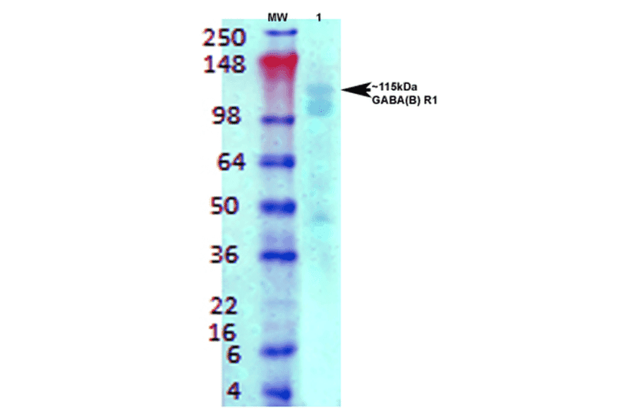 Western Blot - Anti-GABA B Receptor 1 Antibody [S93A-49] (A304759) - Antibodies.com