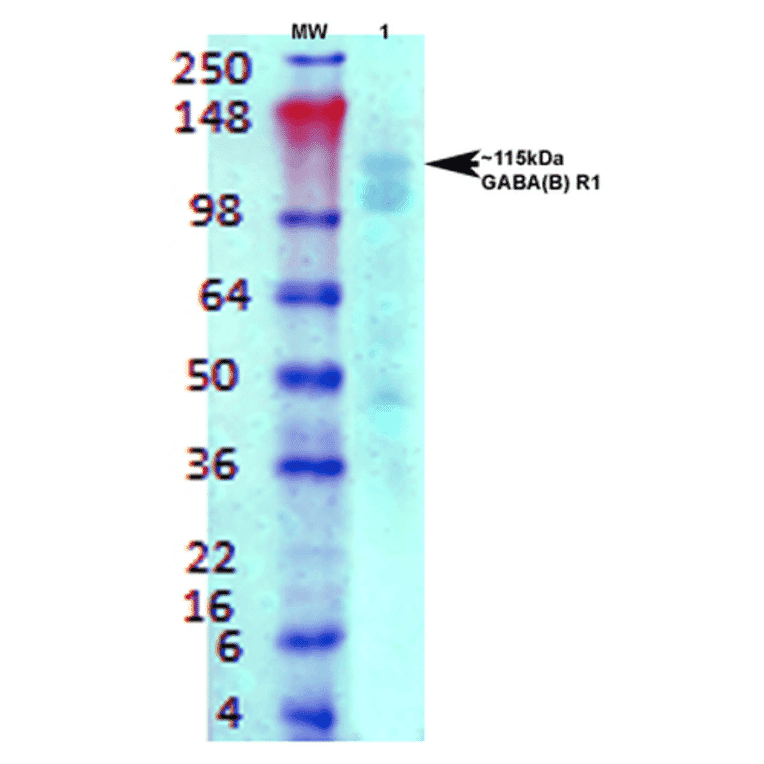 Western Blot - Anti-GABA B Receptor 1 Antibody [S93A-49] (A304759) - Antibodies.com