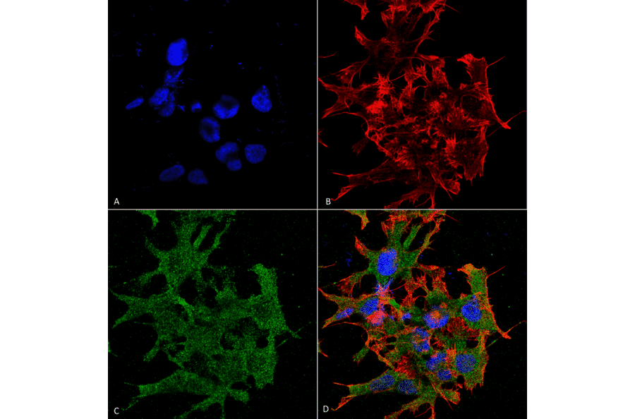 Immunocytochemistry/Immunofluorescence - Anti-GABA B Receptor 1 Antibody [S93A-49] (A304759) - Antibodies.com
