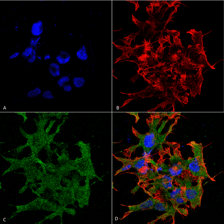 Immunocytochemistry/Immunofluorescence - Anti-GABA B Receptor 1 Antibody [S93A-49] (A304759) - Antibodies.com
