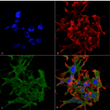 Immunocytochemistry/Immunofluorescence - Anti-GABA B Receptor 1 Antibody [S93A-49] (A304759) - Antibodies.com