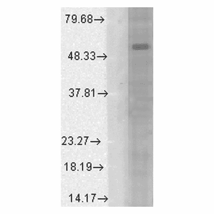Western Blot - Anti-GABA A Receptor alpha 1 Antibody [N95/35] (A304761) - Antibodies.com
