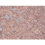 Immunohistochemistry - Anti-GABA A Receptor beta 3 / GABRB3 Antibody [N87/25] (A304762) - Antibodies.com