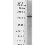Western Blot - Anti-GABA A Receptor beta 3 / GABRB3 Antibody [N87/25] (A304762) - Antibodies.com