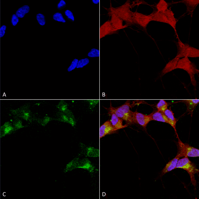 Immunocytochemistry/Immunofluorescence - Anti-GABA A Receptor beta 3 / GABRB3 Antibody [N87/25] (A304762) - Antibodies.com