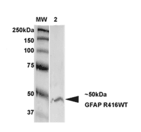Western Blot - Anti-GFAP Antibody [S206B-9] (A304763) - Antibodies.com