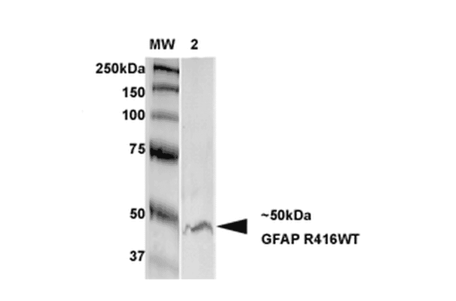 Western Blot - Anti-GFAP Antibody [S206B-9] (A304763) - Antibodies.com