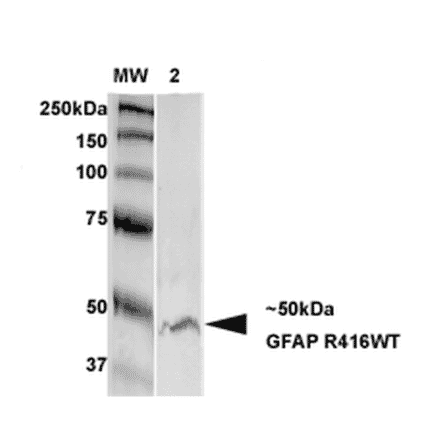 Western Blot - Anti-GFAP Antibody [S206B-9] (A304763) - Antibodies.com