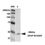 Western Blot - Anti-GFAP Antibody [S206B-9] (A304763) - Antibodies.com