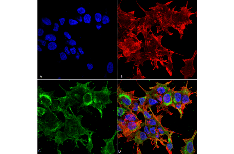 Immunocytochemistry/Immunofluorescence - Anti-GFAP Antibody [S206B-9] (A304763) - Antibodies.com