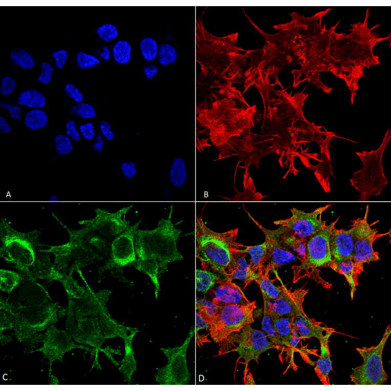 Immunocytochemistry/Immunofluorescence - Anti-GFAP Antibody [S206B-9] (A304763) - Antibodies.com