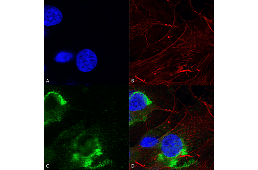 Immunocytochemistry/Immunofluorescence - Anti-GFAP Antibody [S206B-9] (A304763) - Antibodies.com