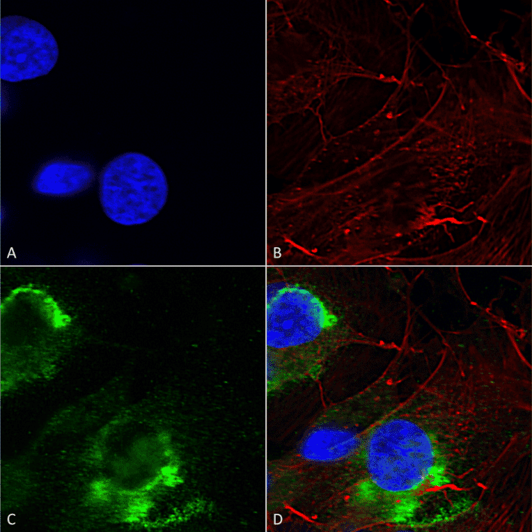 Immunocytochemistry/Immunofluorescence - Anti-GFAP Antibody [S206B-9] (A304763) - Antibodies.com