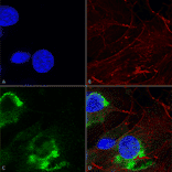 Immunocytochemistry/Immunofluorescence - Anti-GFAP Antibody [S206B-9] (A304763) - Antibodies.com