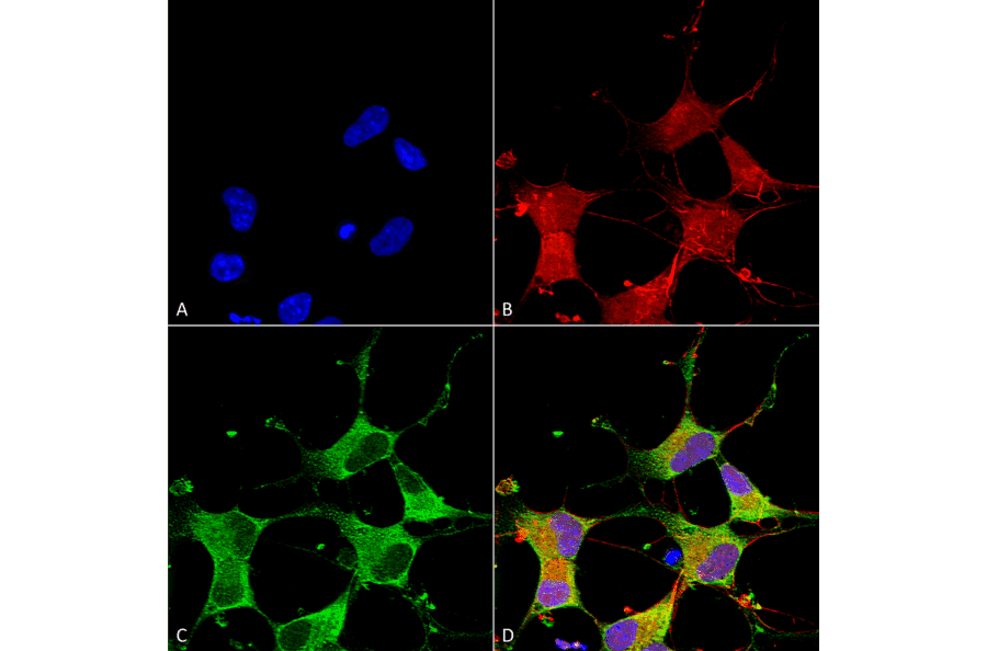 Immunocytochemistry/Immunofluorescence - Anti-GIT1 Antibody [S39B-8] (A304764) - Antibodies.com