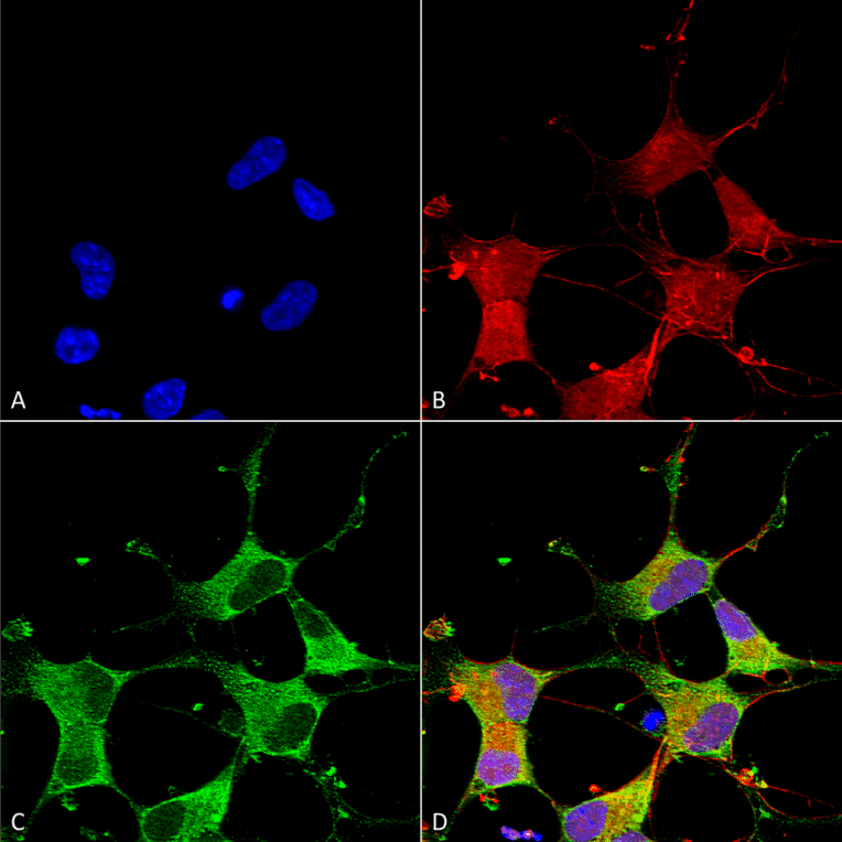 Immunocytochemistry/Immunofluorescence - Anti-GIT1 Antibody [S39B-8] (A304764) - Antibodies.com