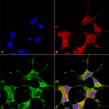 Immunocytochemistry/Immunofluorescence - Anti-GIT1 Antibody [S39B-8] (A304764) - Antibodies.com