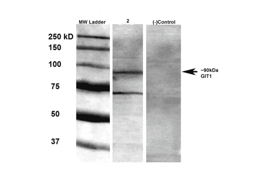 Western Blot - Anti-GIT1 Antibody [S39B-8] (A304764) - Antibodies.com