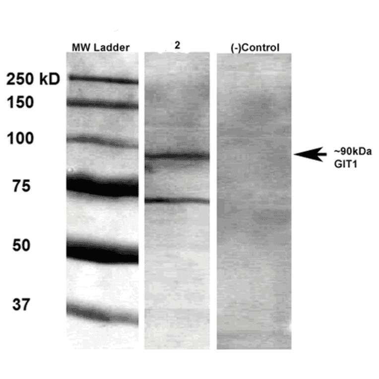 Western Blot - Anti-GIT1 Antibody [S39B-8] (A304764) - Antibodies.com