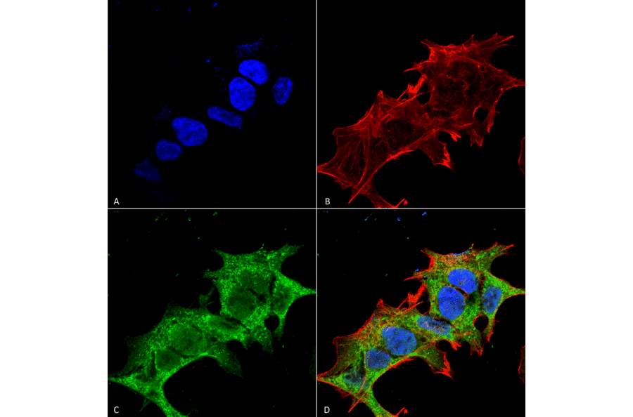 Immunocytochemistry/Immunofluorescence - Anti-GIT1 Antibody [S39B-8] (A304764) - Antibodies.com