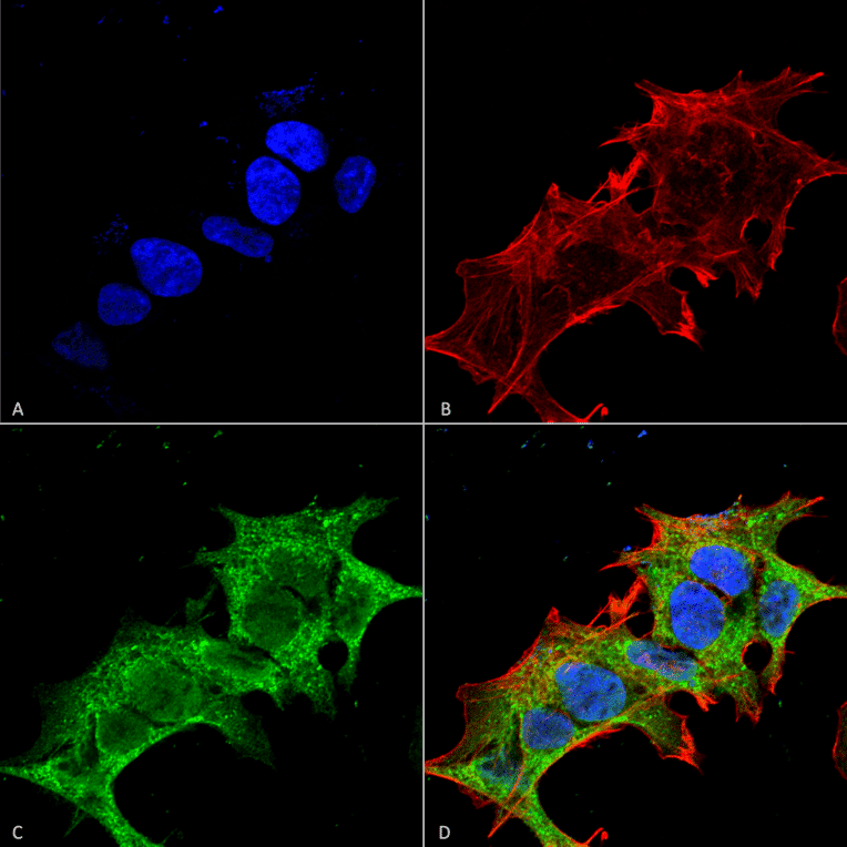 Immunocytochemistry/Immunofluorescence - Anti-GIT1 Antibody [S39B-8] (A304764) - Antibodies.com