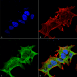 Immunocytochemistry/Immunofluorescence - Anti-GIT1 Antibody [S39B-8] (A304764) - Antibodies.com