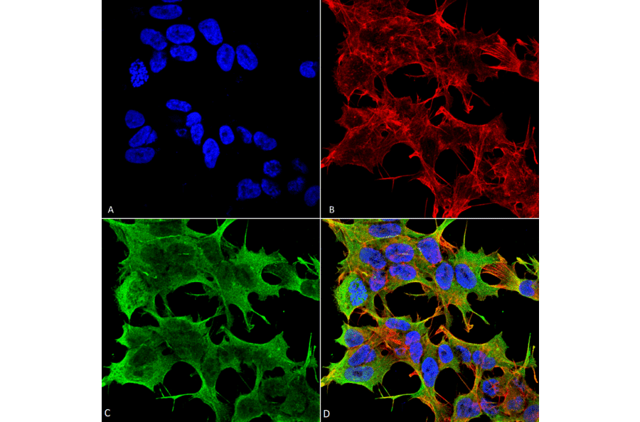 Immunocytochemistry/Immunofluorescence - Anti-Glutamate Receptor 1 (AMPA subtype) Antibody [S355-1] (A304766) - Antibodies.com