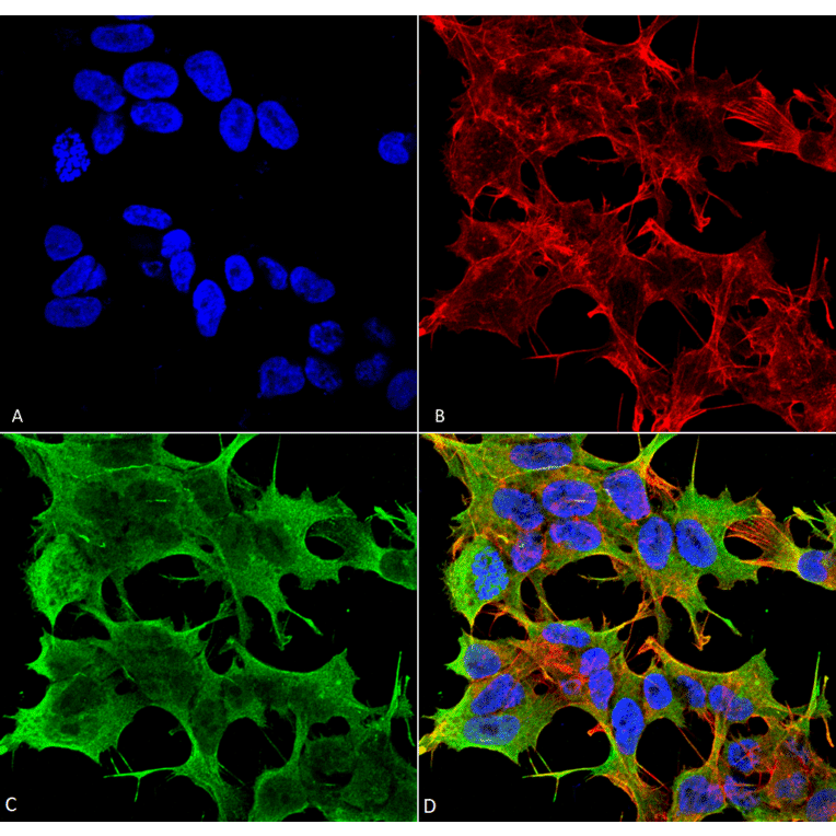 Immunocytochemistry/Immunofluorescence - Anti-Glutamate Receptor 1 (AMPA subtype) Antibody [S355-1] (A304766) - Antibodies.com