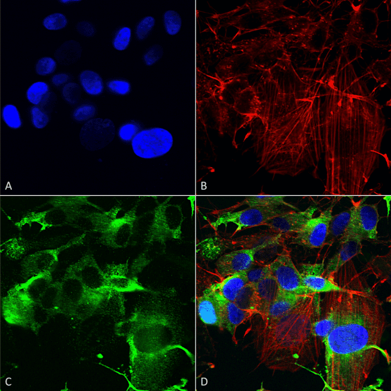 Immunocytochemistry/Immunofluorescence - Anti-Glutamate Receptor 1 (AMPA subtype) Antibody [S355-1] (A304766) - Antibodies.com