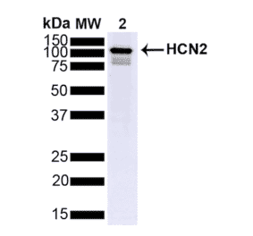 Western Blot - Anti-HCN2 Antibody [S71] (A304767) - Antibodies.com