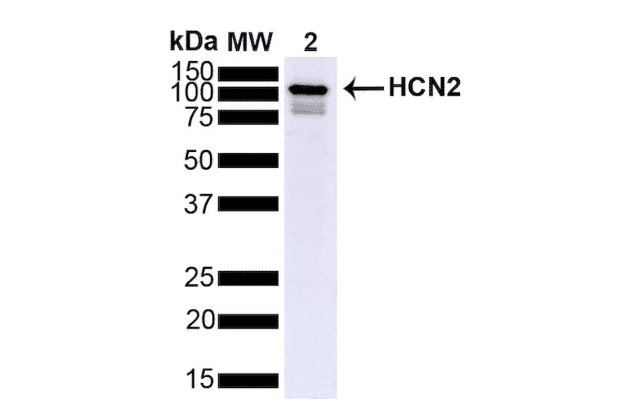 Western Blot - Anti-HCN2 Antibody [S71] (A304767) - Antibodies.com